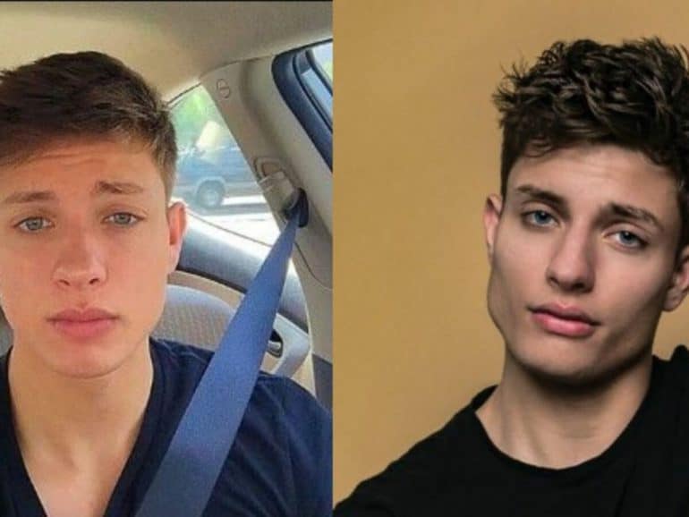 Matt Rife Before And After Did The Comedian Undergo Plastic Surgeries