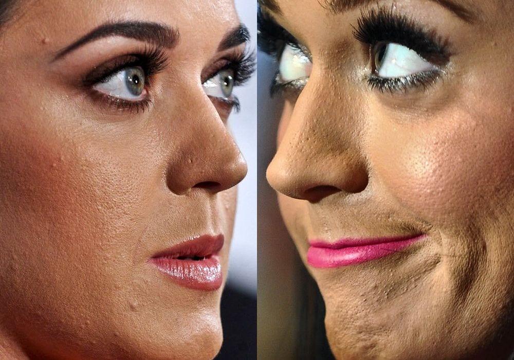 20 Celebrity Unedited Pictures And The Times They Weren t Afraid To Show Their Real Self - 17