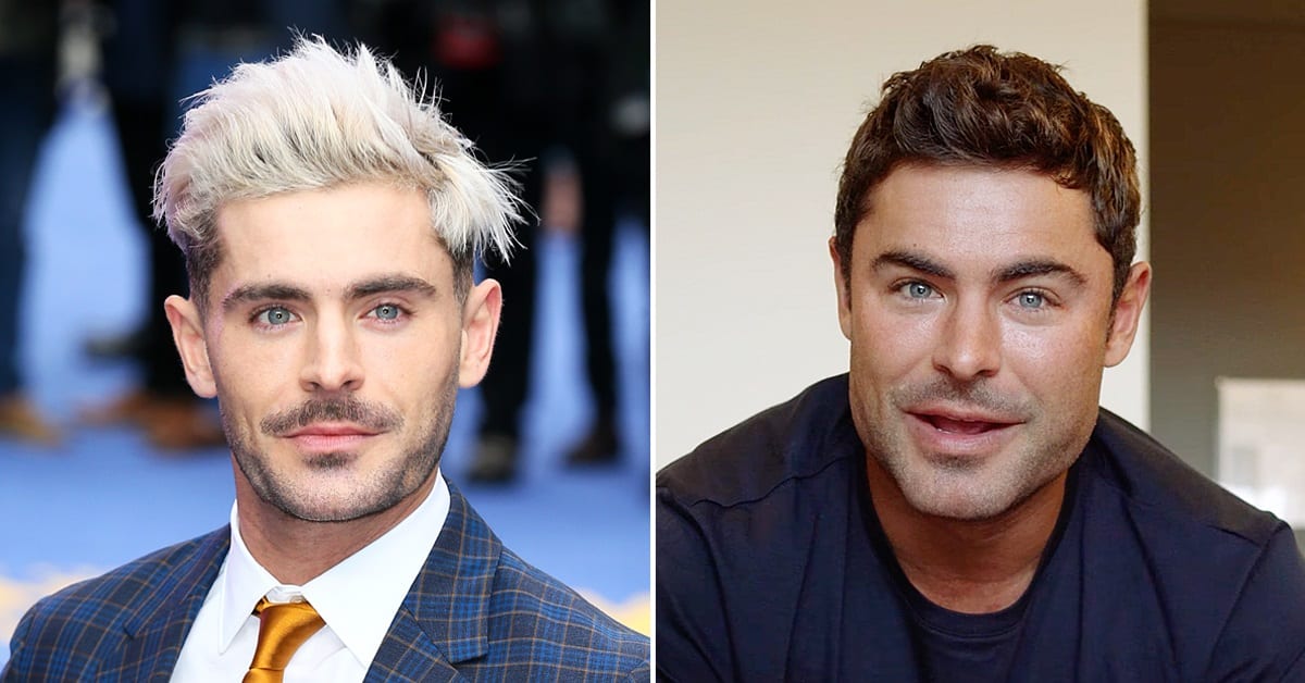 Did Zac Efron Get A Plastic Surgery For His Jaw Before After Look