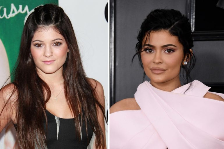 Kylie Jenner S Transformation Personal Life And Career Otakukart