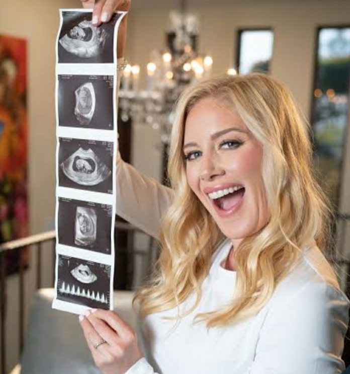 Is Heidi Montag Pregnant In 2022 Just Go With It Actress Sparks 
