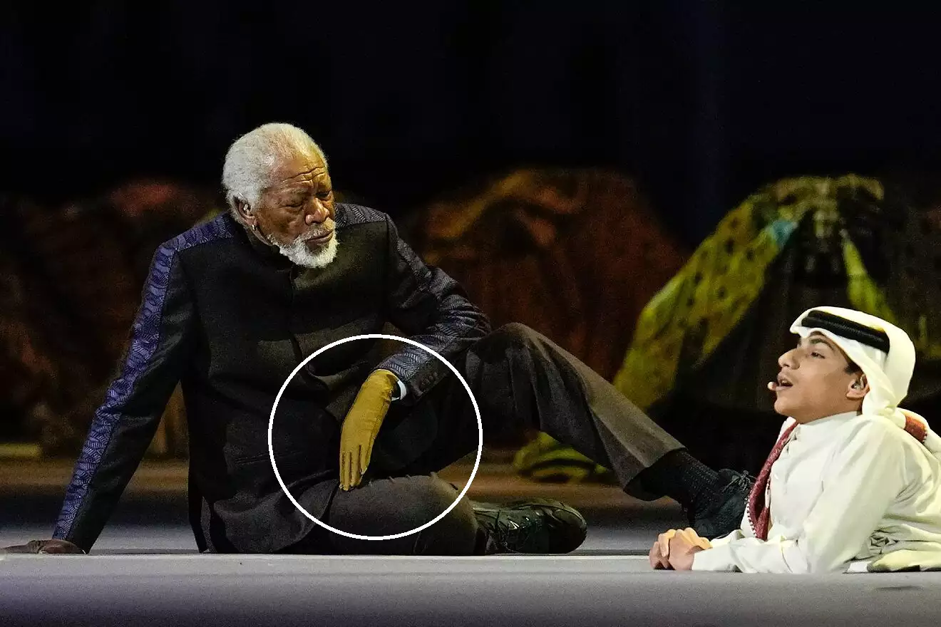 What Happened To Morgan Freeman's Hand?
