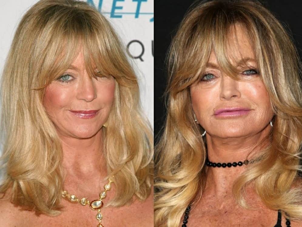 What Happened To Goldie Hawn's Face?
