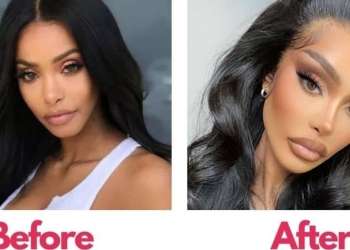 Jodie Joe Before And After. Know Everything About Her Transformation