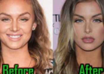 Lala Kent Before And After Know Everything About Her Transformation