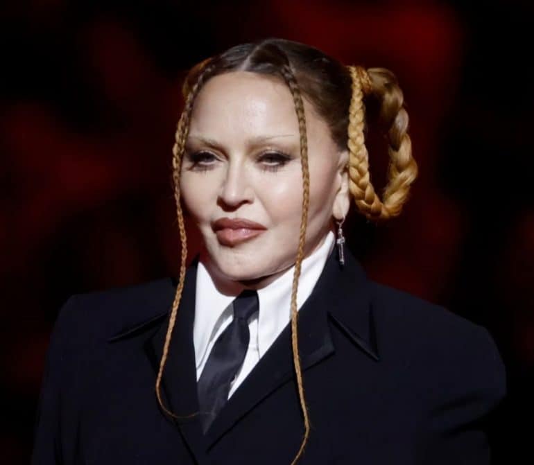 What Happened To Madonna's Face? The Queen Of Pop's Plastic Surgery
