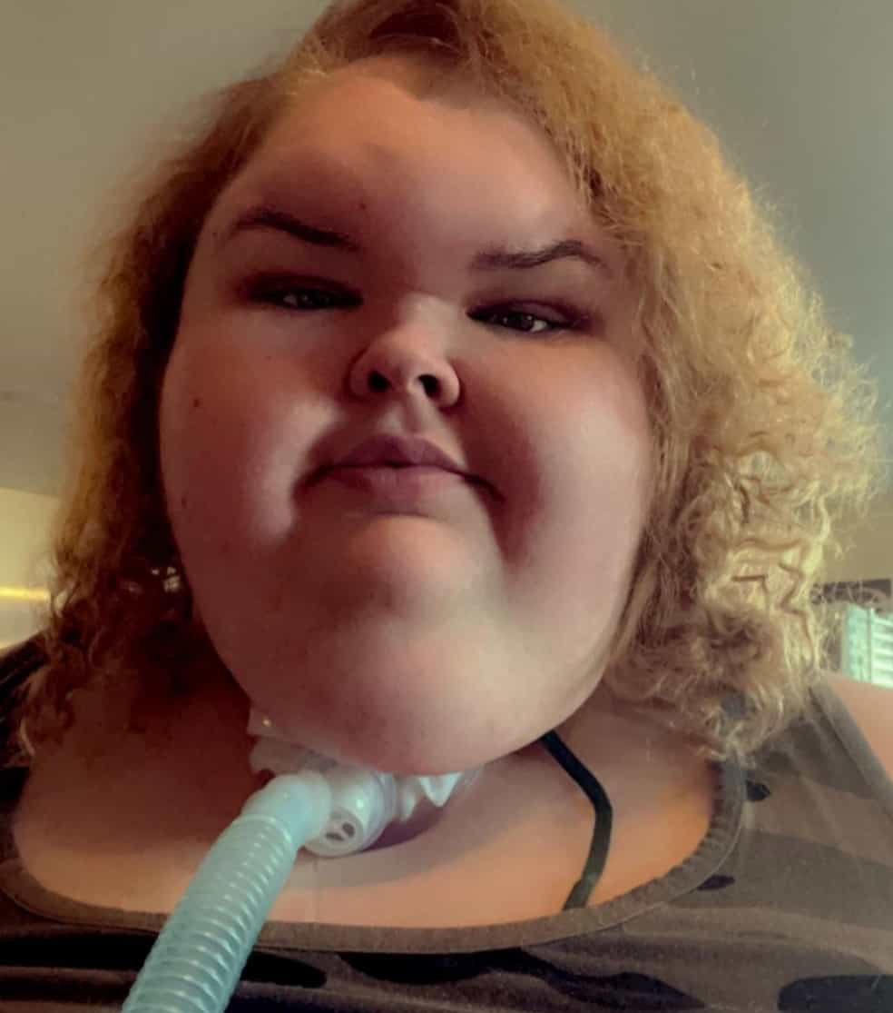 Why Does Tammy Slaton From 1000-lb Sisters Have A Trach?