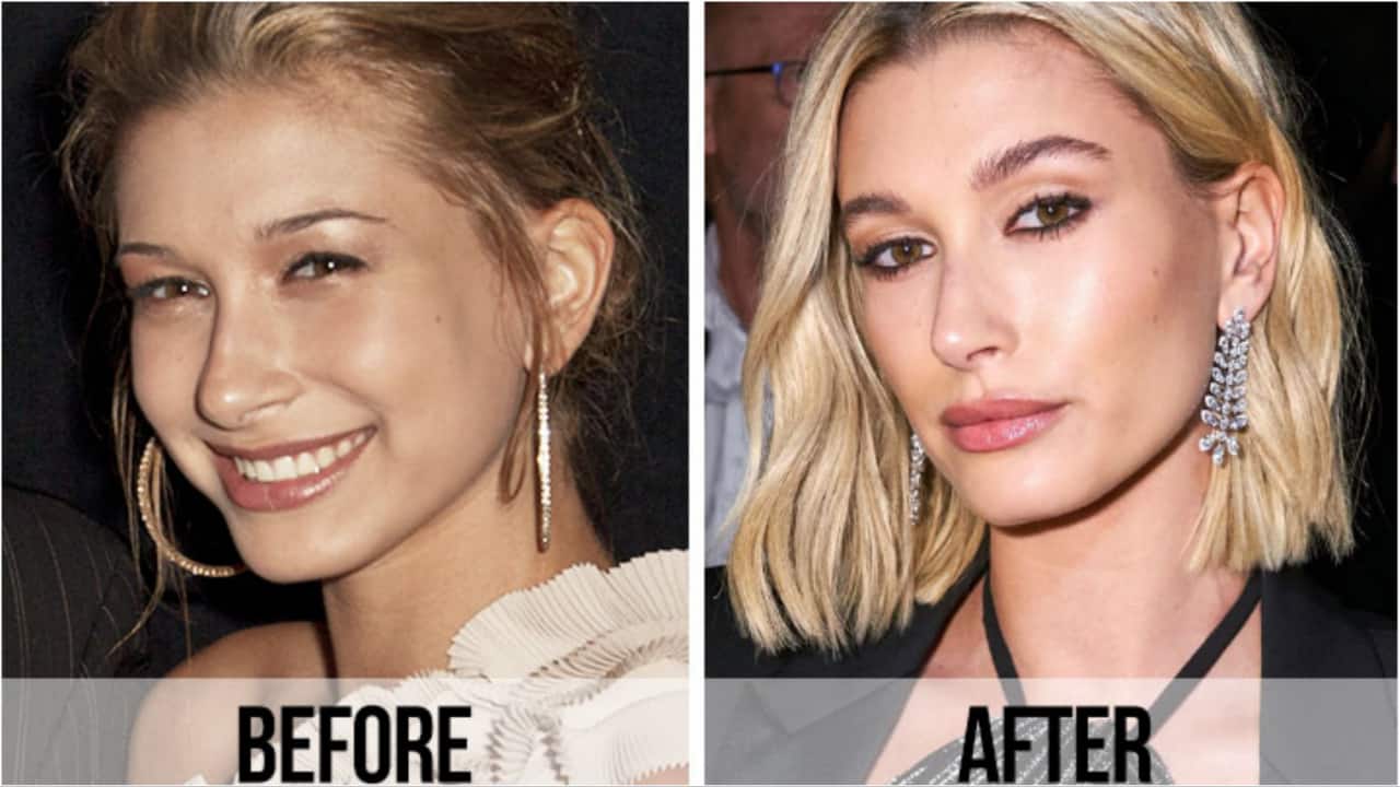 Hailey Bieber Before And After
