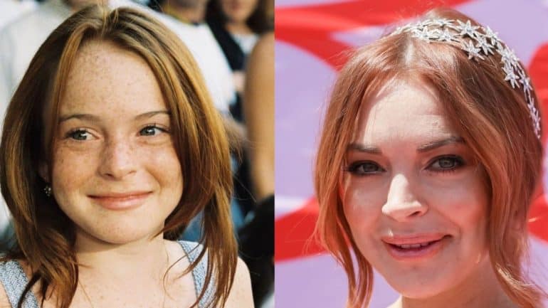 Lindsay Lohan before and after