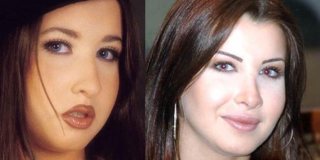 Nancy Ajram Before and After- Has the Lebanese Singer Undergone Plastic Surgery