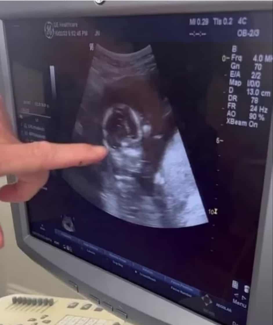 Riana Crehan Pregnant