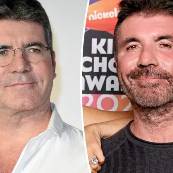Simon Cowell's Before And After Looks