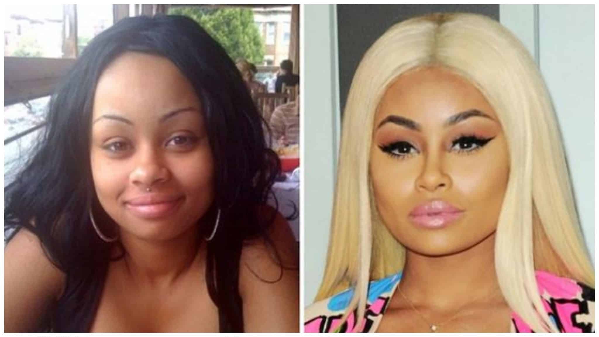 Blac Chyna's Before And After Transformation Explained OtakuKart