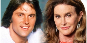 caitlyn jenner before and after