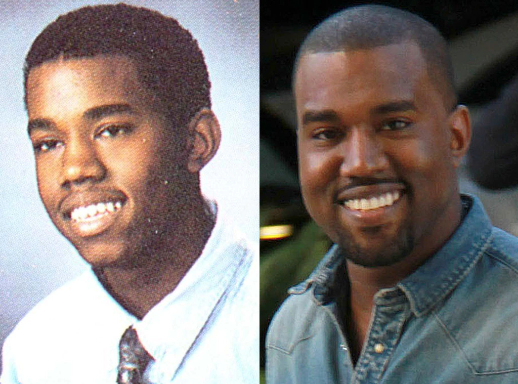 kanye before and after