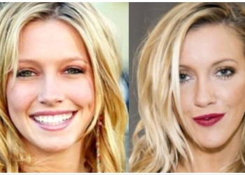 katie cassidy before and after