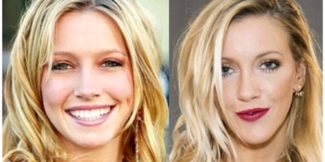 katie cassidy before and after