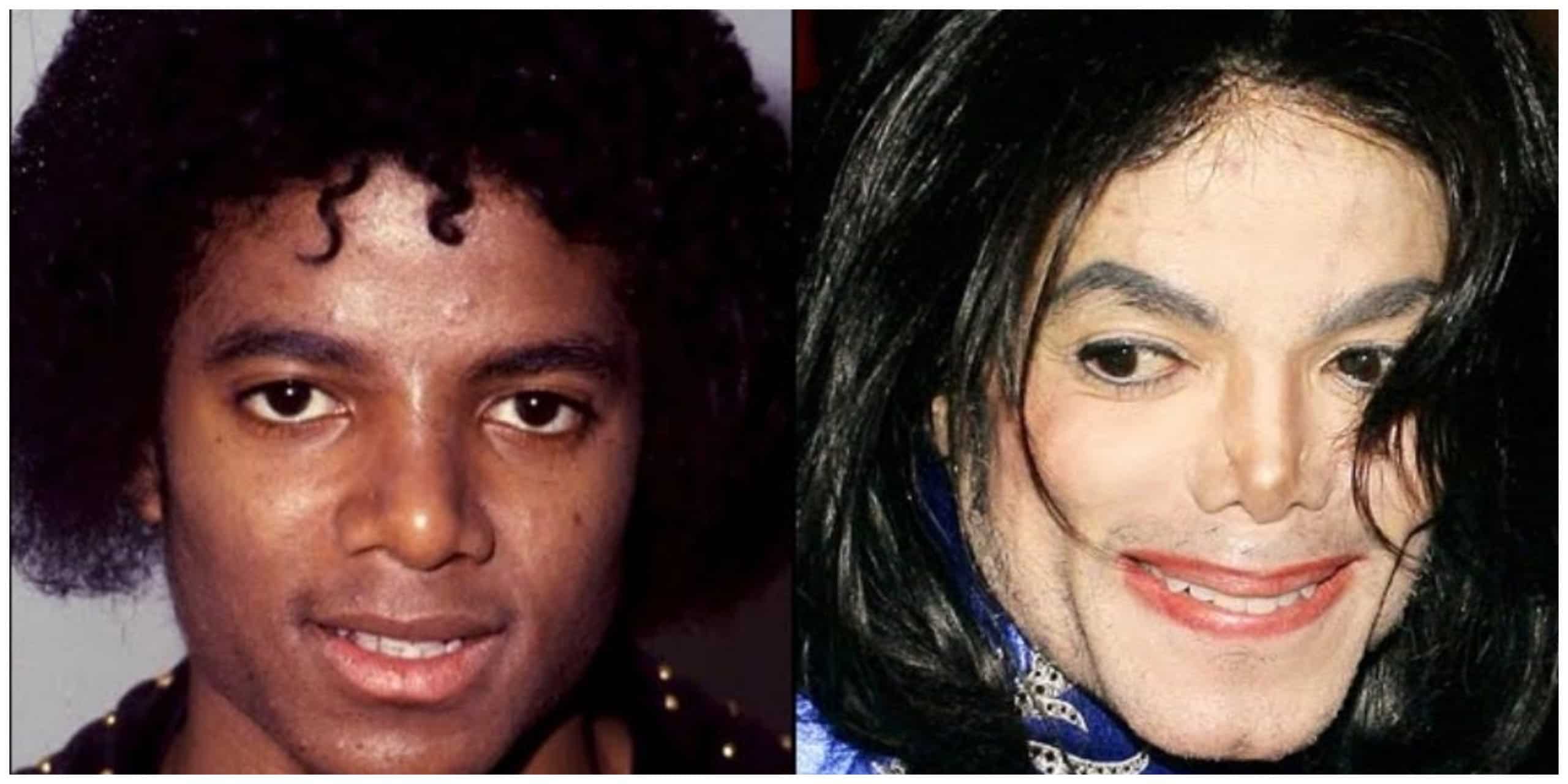 Michael Jackson before and after