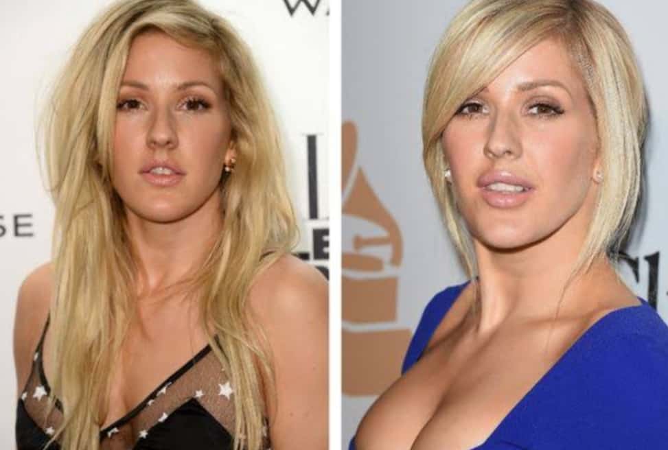Ellie Goulding's Before And After Looks