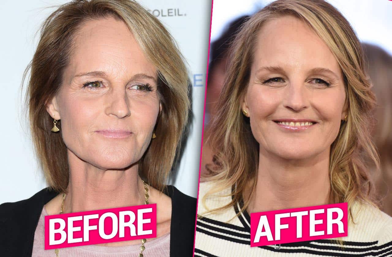 Helen Hunt Transformation Before and After Photos OtakuKart