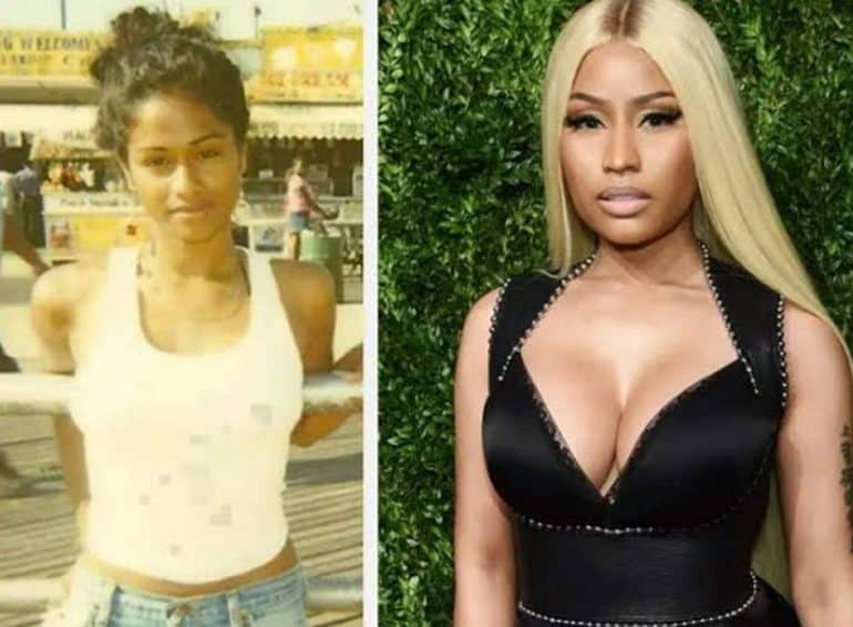 Nicki Minaj Transformation Before And After Otakukart 6760