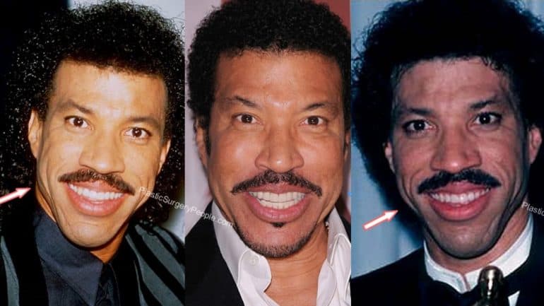 Lionel Richie