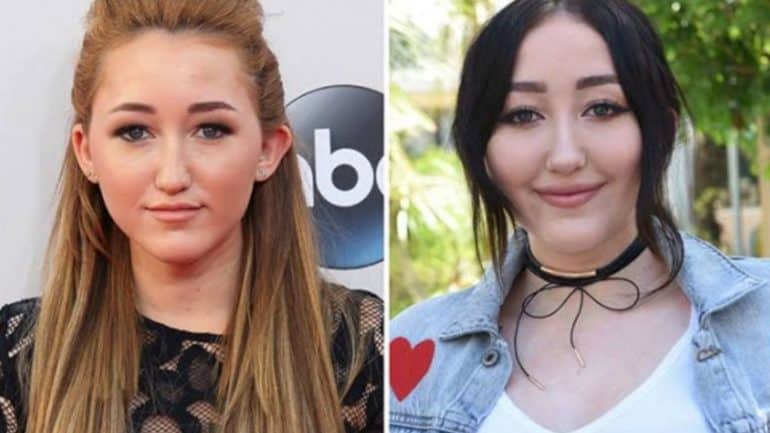 Noah Cyrus' before and after looks