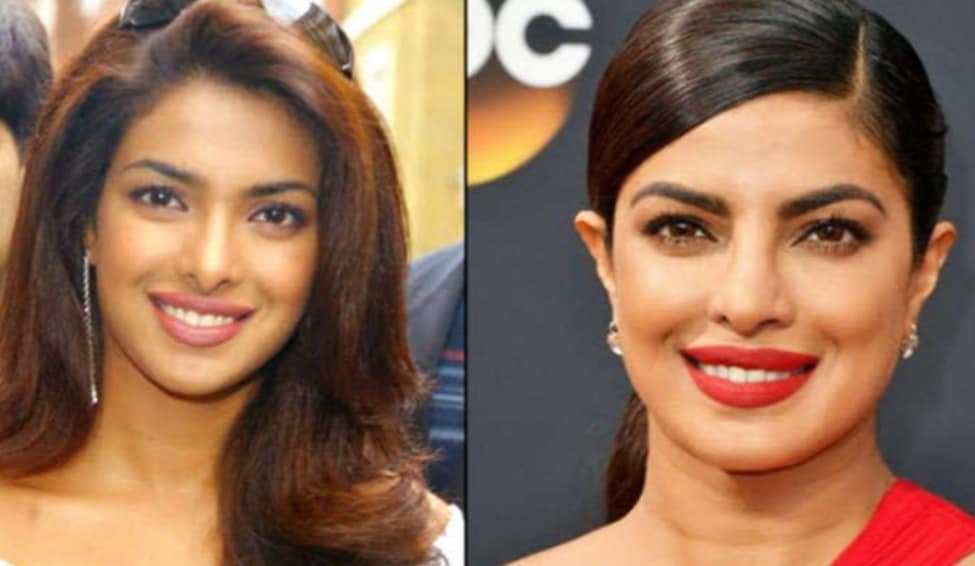 Priyanka Chopra's Before And After Looks: