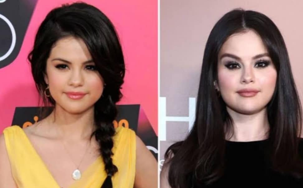 Selena Gomez's Before And After Looks