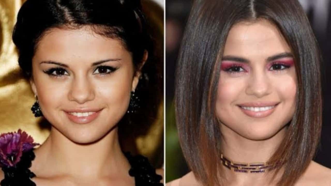 Selena Gomez's Before And After Looks