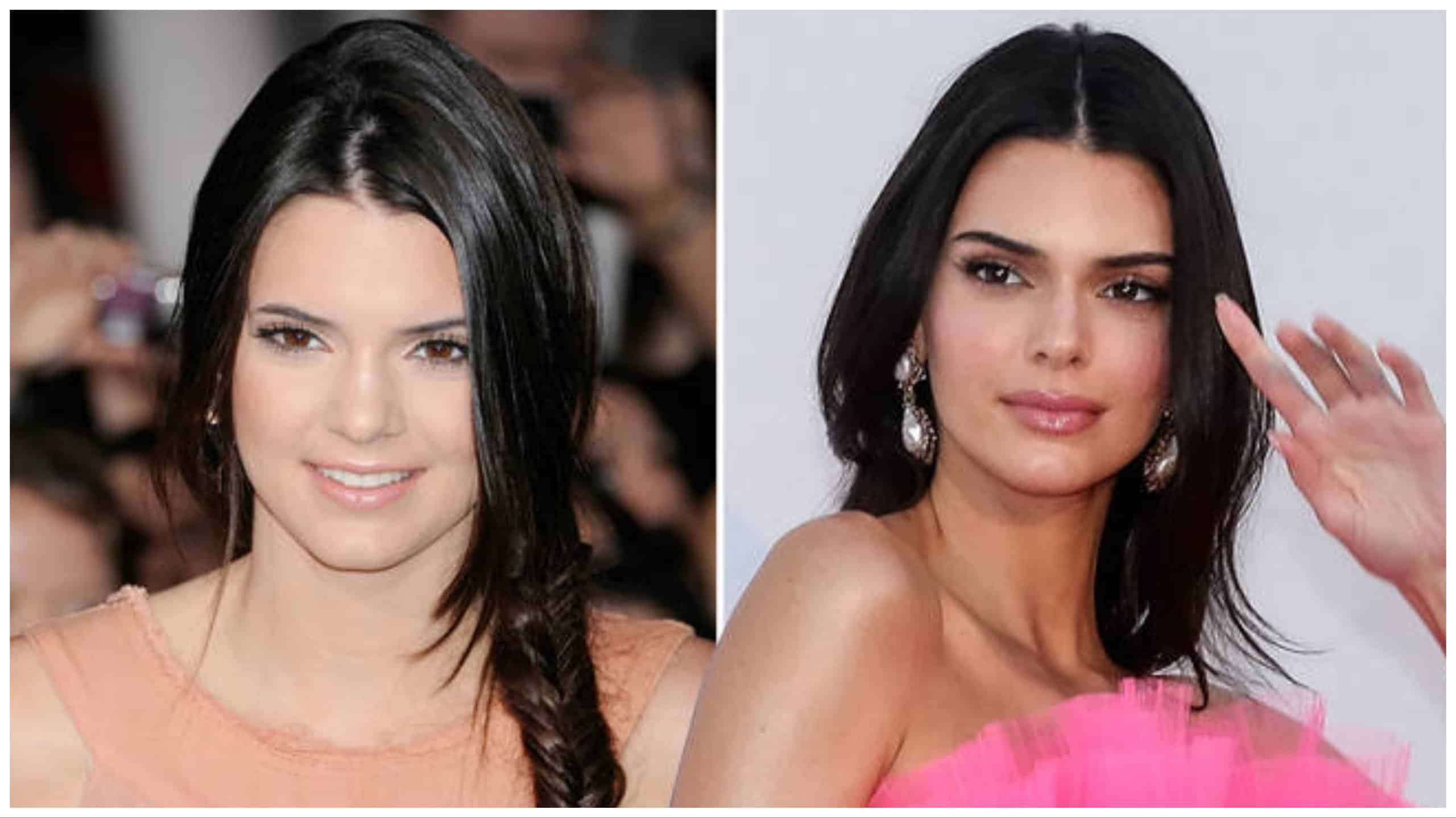 kendall jenner before and after