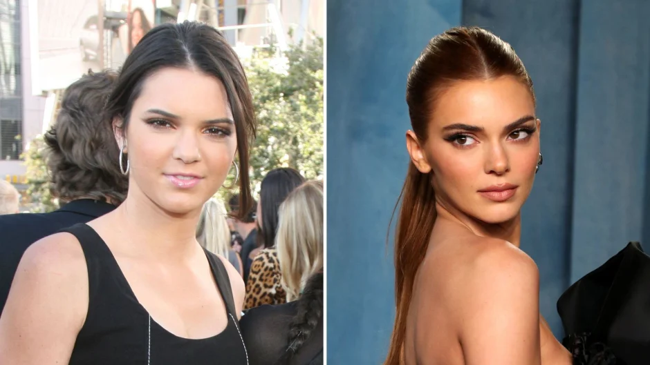 kendall jenner before and after