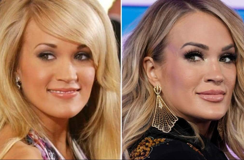 Carrie Underwood antes e depois