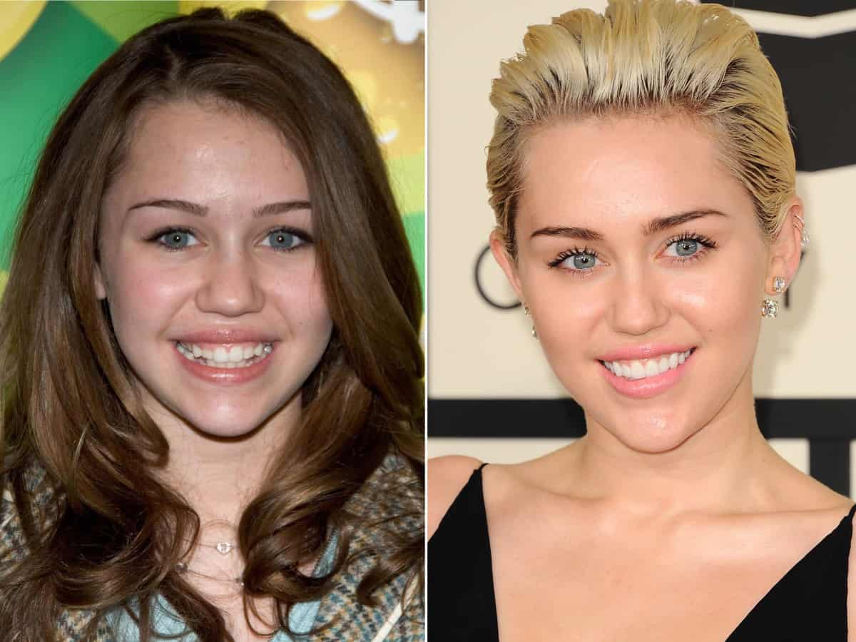 Miley Cyrus Before (L) and After (R)