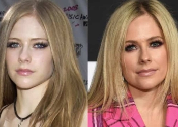 Avril Lavigne Then And Now
