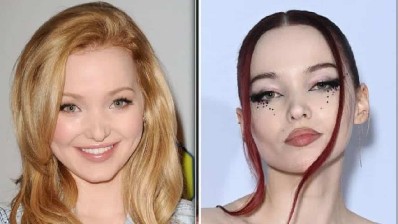 Dove Cameron Before And After