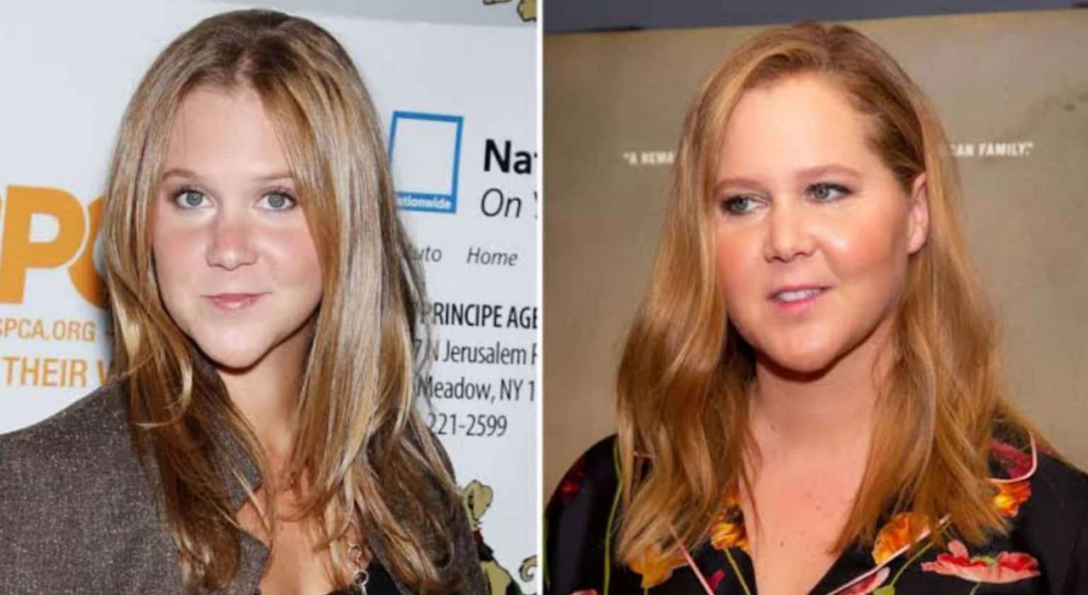 Amy Schumer Before & After: Comedian's Transformation Through The Years ...