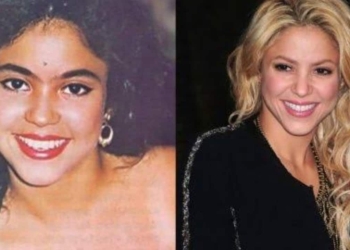 Shakira Before And After