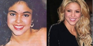 Shakira Before And After