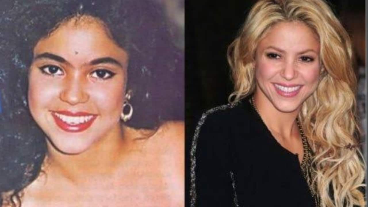 Shakira Before And After
