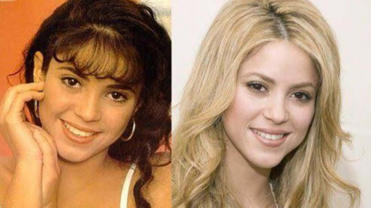 Shakira antes y despues