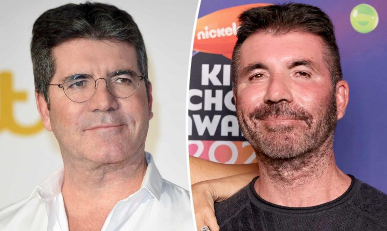 What Happened To Simon Cowell's Face?