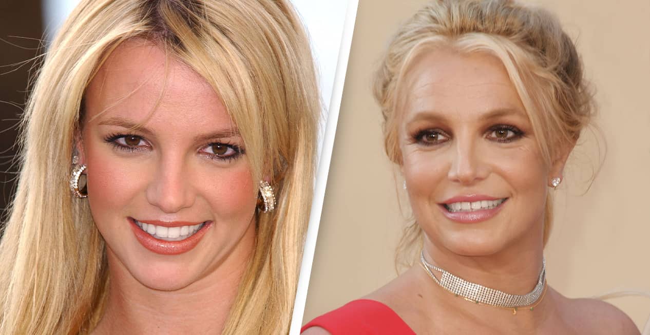 Los dientes de Britney antes vs ahora.