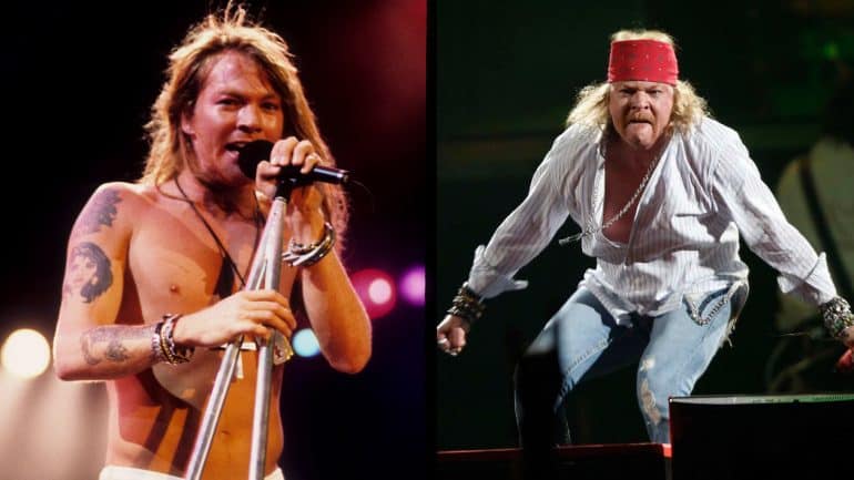 Axl Rose Before And After: How the Singer Transformed - OtakuKart