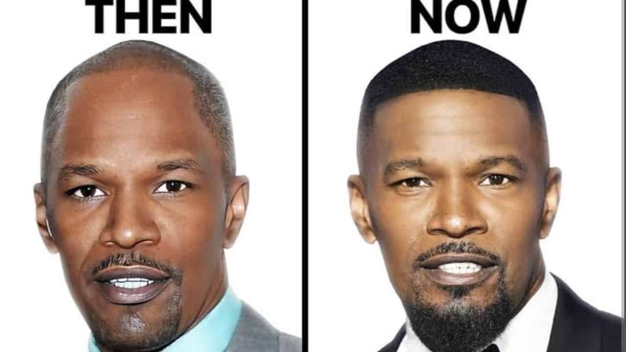 Jamie Foxx Before And After