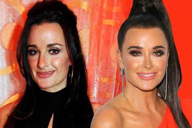 Kyle Richards Before And After: The Real Housewives Of Beverly Hills ...