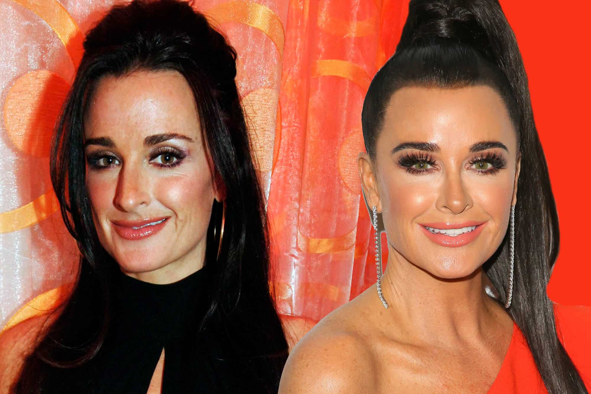 Kyle Richards Before and After Her Nose Surgery (Credits: US Weekly)