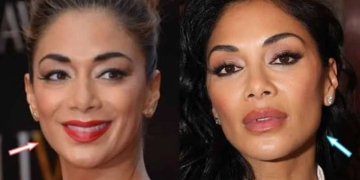 Nicole Scherzinger Before And After