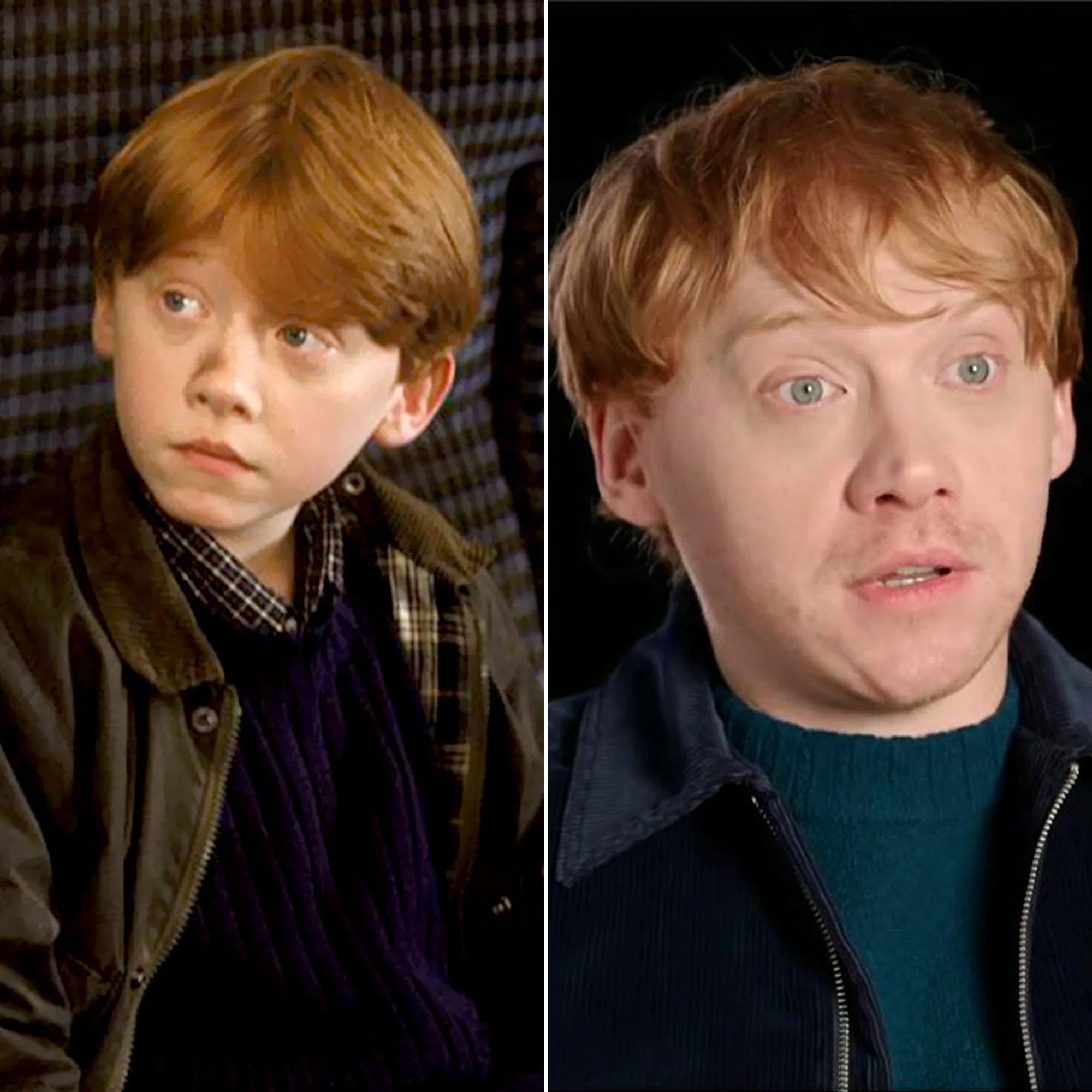 Rupert Grint Then (Left) and Now (Right) (Credits: US Weekly)