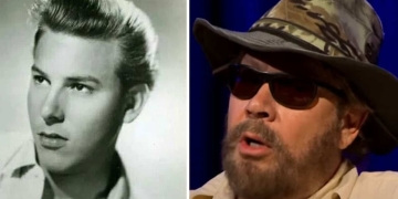 Hank Williams Jr Before and After Accident